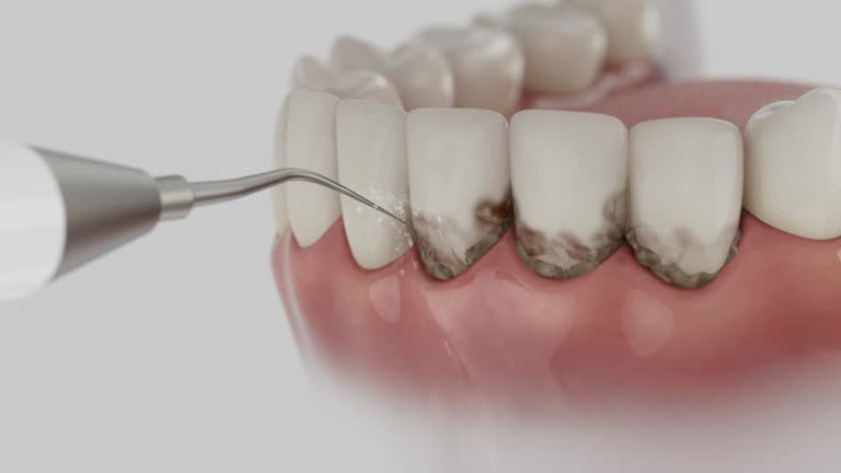 Trusted Root Canal Treatment service in Roanoke, IL - Dentist Open Now
